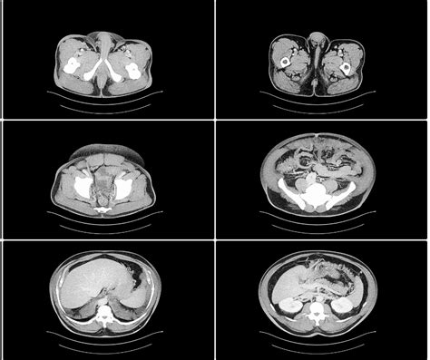 How incidental radiology findings can lead to malpractice litigation