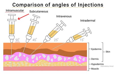 How injection is given
