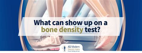 How is a bone density done