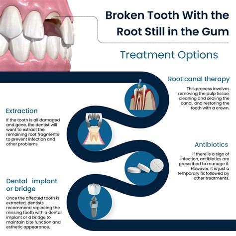 How is a broken tooth removed
