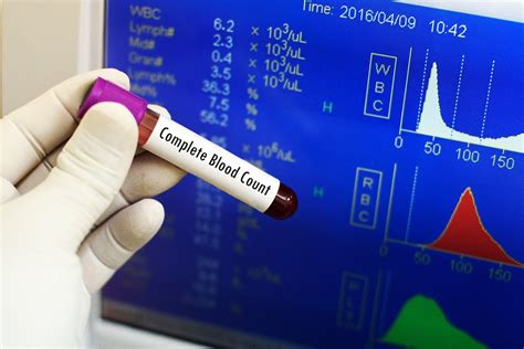 How is a cbc test performed