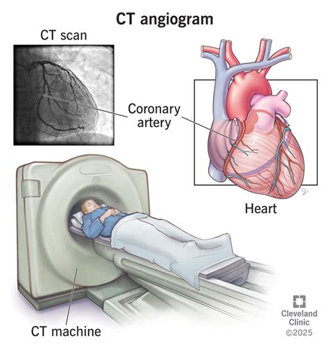 How is a heart ct scan done