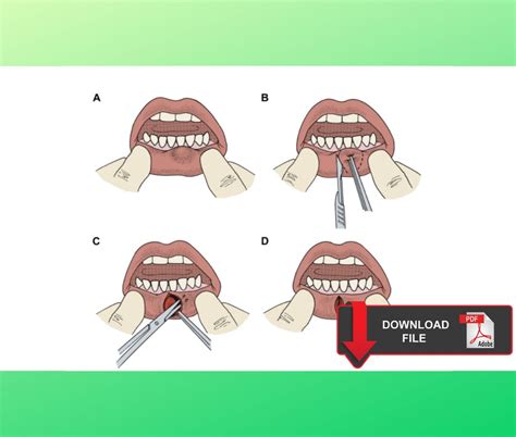 How is a tongue biopsy performed