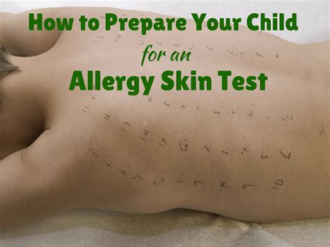 How is allergy testing done on toddlers