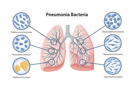 How is bacterial pneumonia transmitted