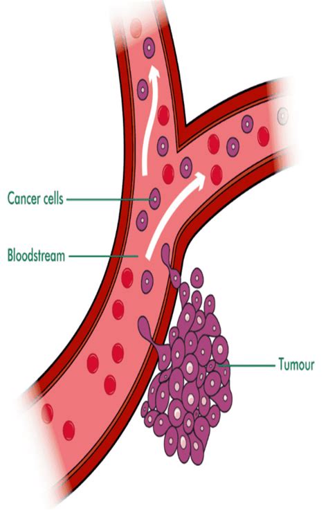 How is cancer transmitted