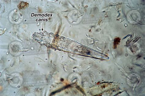 How is demodex transmitted