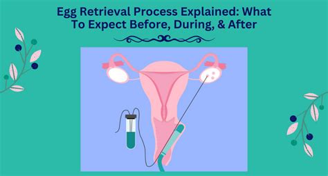 How is egg retrieval performed