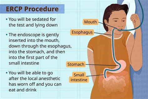 How is ercp done