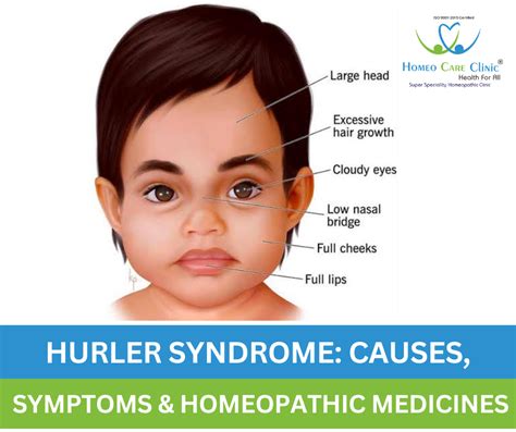 How is hurler syndrome inherited