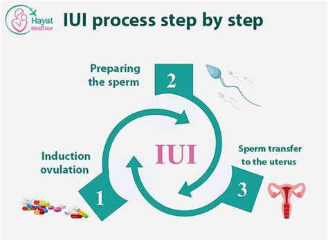 How is iui done step by step