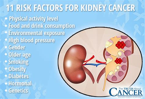 How is kidney cancer causes