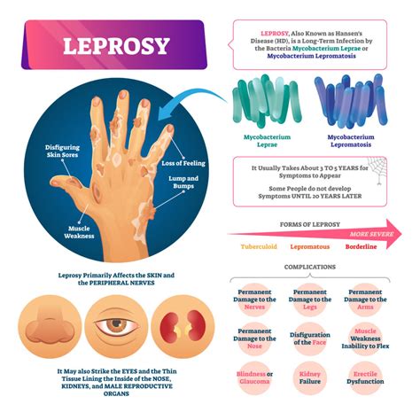 How is leprosy caused