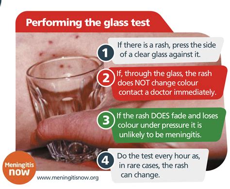 How is meningitis tested