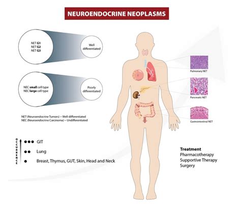 How is neuroendocrine cancer diagnosed