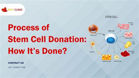 How is stem cell donation done