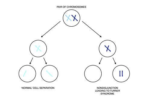 How is turner syndrome inherited