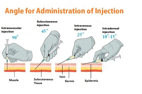 How iv injection is given