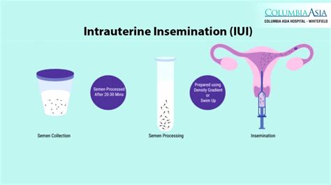 How long before iui should you abstain