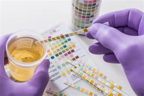 How long does labcorp take for urine results. 2 - 4 days. Turnaround time is defined as the usual number of days from the date of pickup of a specimen for testing to when the result is released to the ordering provider. 