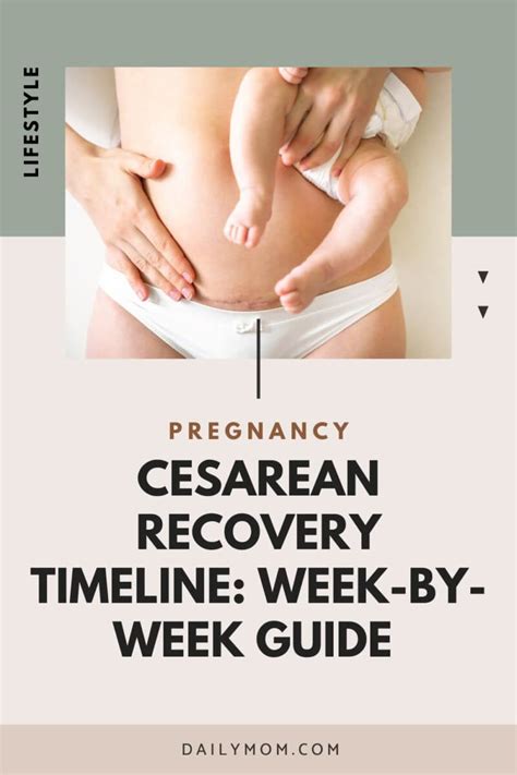 How long in recovery after c section