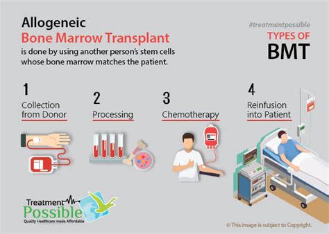 How long is a bone marrow transplant