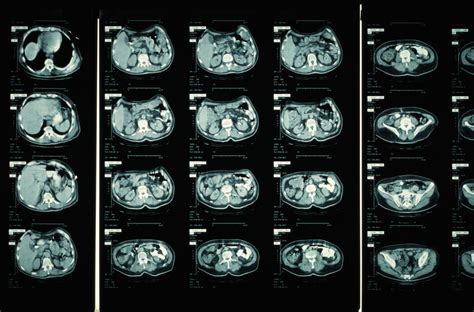 How long is a brain ct scan