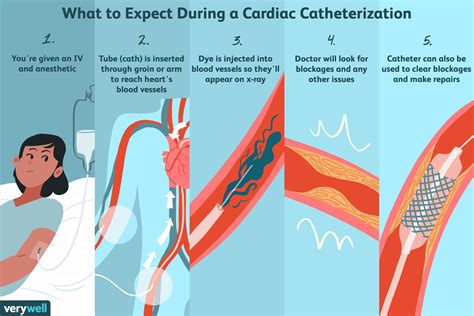 How long is a cardiac catheterization procedure