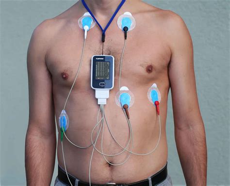 How long is a holter monitor worn