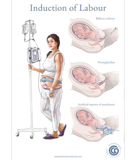 How long is induced labour