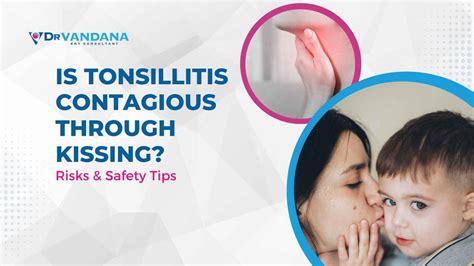 How long is tonsillitis contagious for kissing