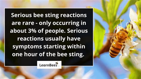 How long should a bee sting hurt