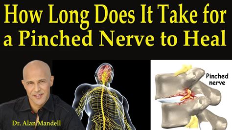 How long should a pinched nerve last