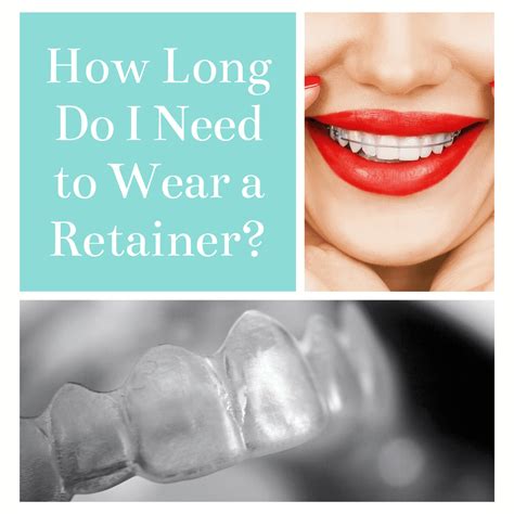 How long should a retainer be worn