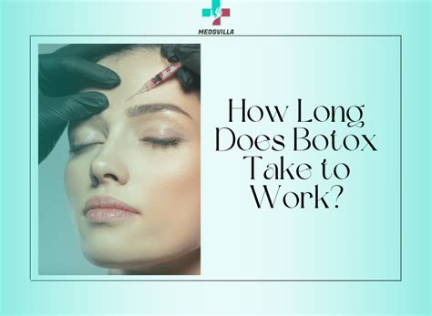 How long should botox take to work