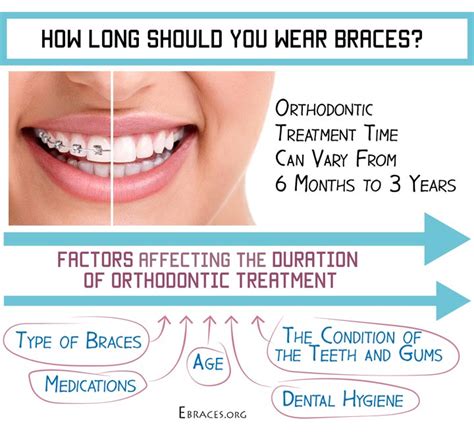 How long should braces last