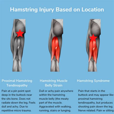 How long should i ice my hamstring