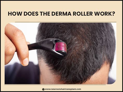 How long should i use derma roller