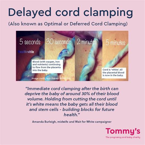How long should you delay cord clamping