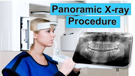How long to get panorama results. The results are reported as either high risk for a specific aneuploidy, high risk due to fetal fraction, insufficient fetal DNA, atypical, high risk, or no ... 