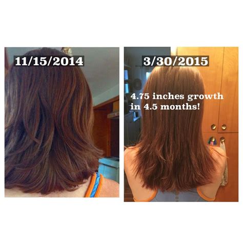 How many inches will hair grow in a month. Apr 6, 2022 · During the yearslong anagen phase, the hair on your scalp can grow a third of an inch (1 centimeter) every 28 or so days — that would be about 5 inches (13 centimeters) a year. But how fast it really grows depends on things like your age, genetics, type of hair and overall health. A 2016 study published in the European Journal of Dermatology ... 