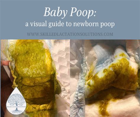 How many poops is your baby doing? - March 2024 Babies