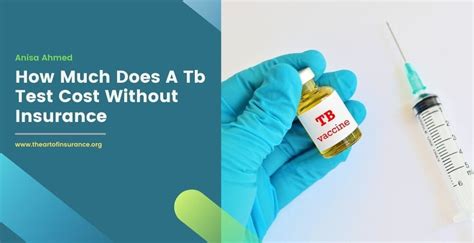 How much does a tb test cost without insurance. Type of Test: TST Cost: $35 for placement and $29 for reading, do not accept insurance, do not have sliding scale fee Appointment: Do not need an appointment. Can use online feature to hold place in line at the clinic (cvs.com) Heartland Health Center Location: Albany Park: 3737 W. Lawrence Ave Hours: M-F 8:30-5pm, Closed Weekends 