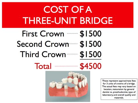 How much should a bridge cost