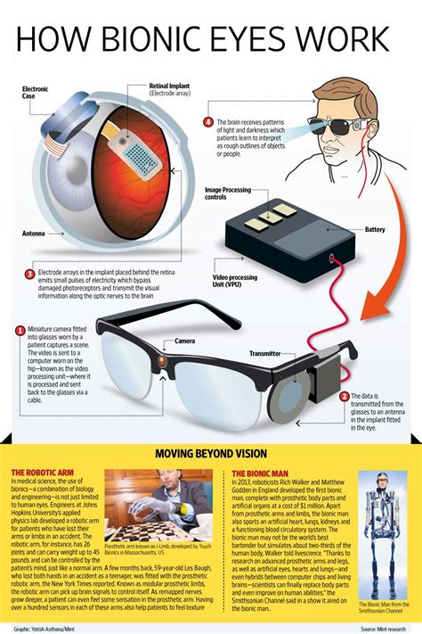 How much will bionic eyes cost