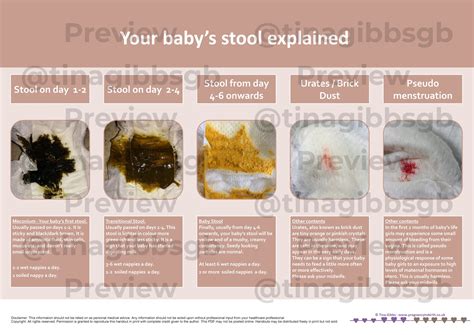 How often should a newborn pass stool