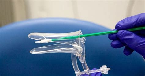 How often should have smear test