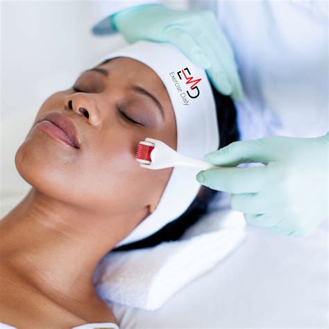 How often should you get microneedling