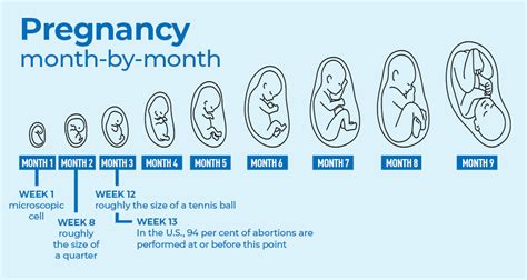 How one month abortion is done