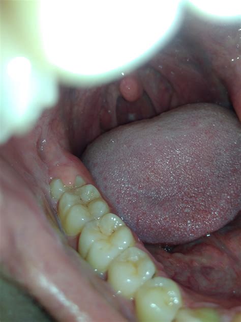 How risky is unprotected oral